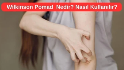 Uyuz Kremi Wilkinson Pomad Nedir? Ne İşe Yarar?